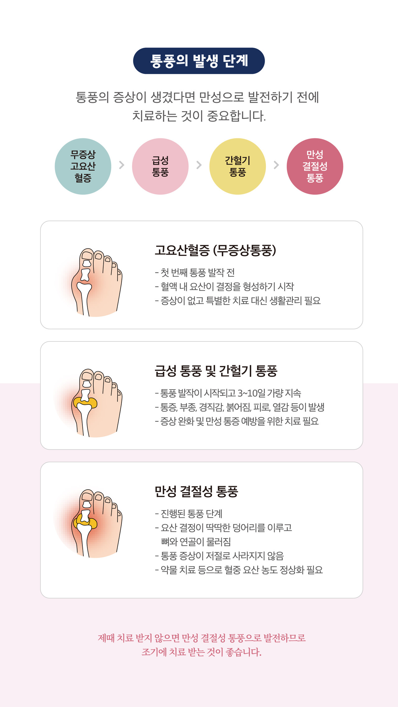 통풍 무증상 고요산혈증 급성통풍 간헐기통풍 만성결절성통풍 류마티스내과