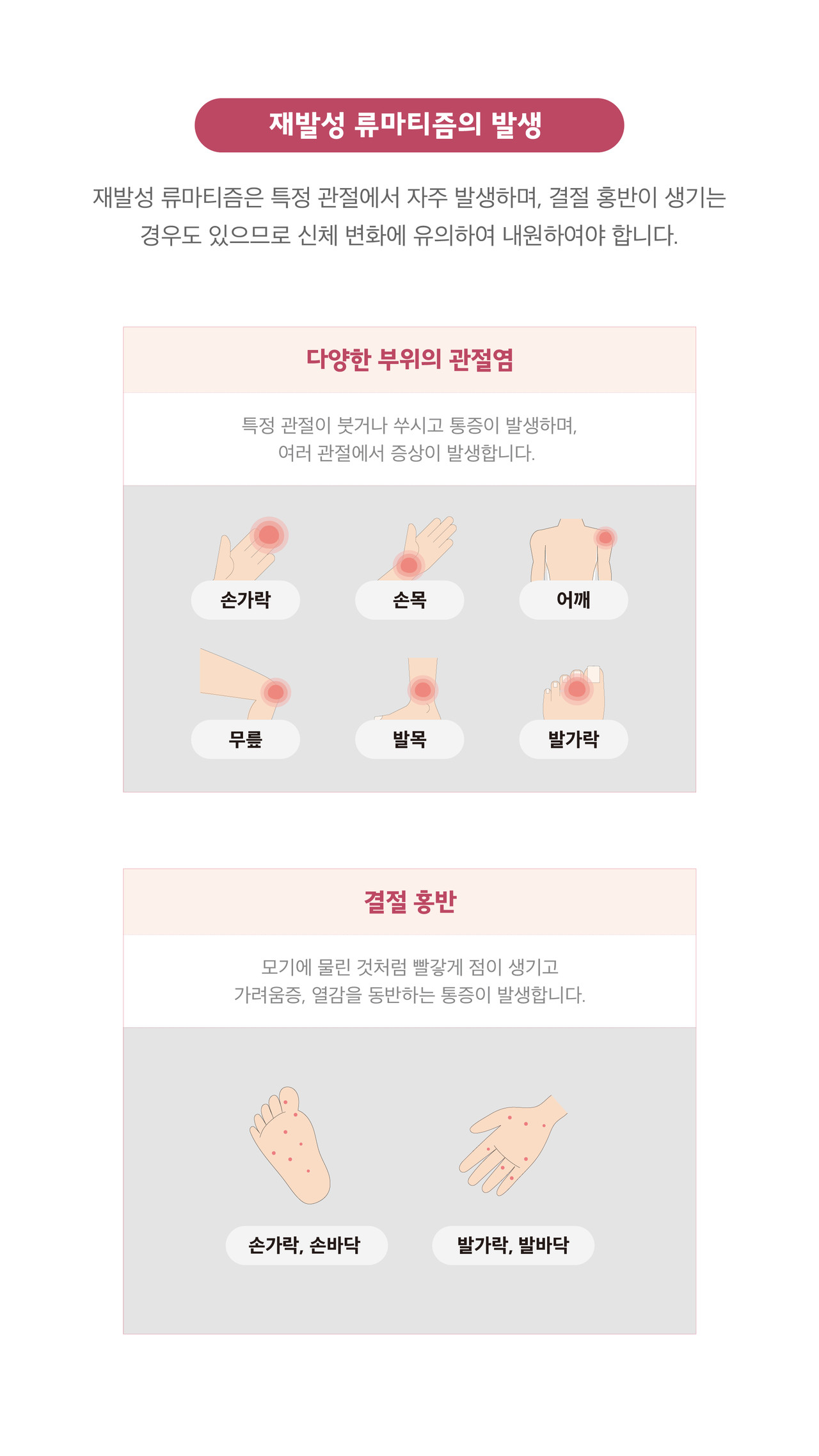 재발성류마티즘 결절홍반 