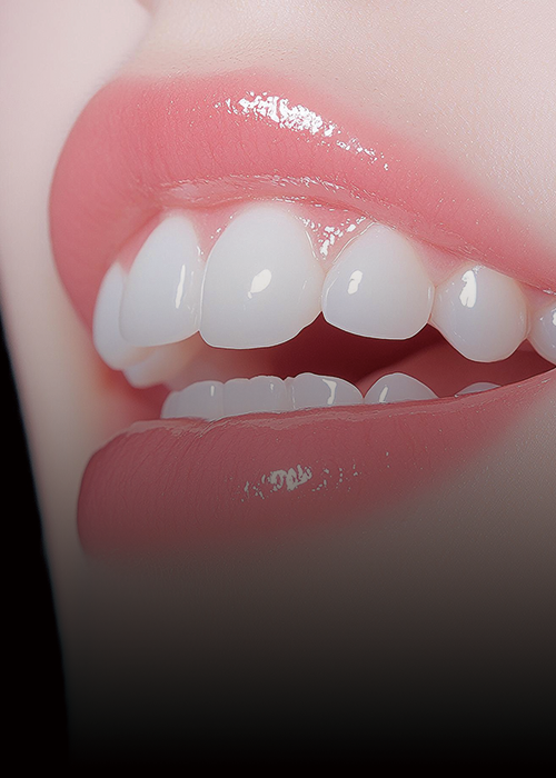 <p><strong><span style="font-size: 36px; letter-spacing: -1px;">라미네이트</span></strong></p>  <p style="line-height: 1;"><span style="letter-spacing: -1px;"><span style="font-size: 18px;">자연스러운 치아를 가질 수 있으며 </span></span><span style="letter-spacing: -1px;"><span style="font-size: 18px;">내원 당일 완성 가능</span></span></p>