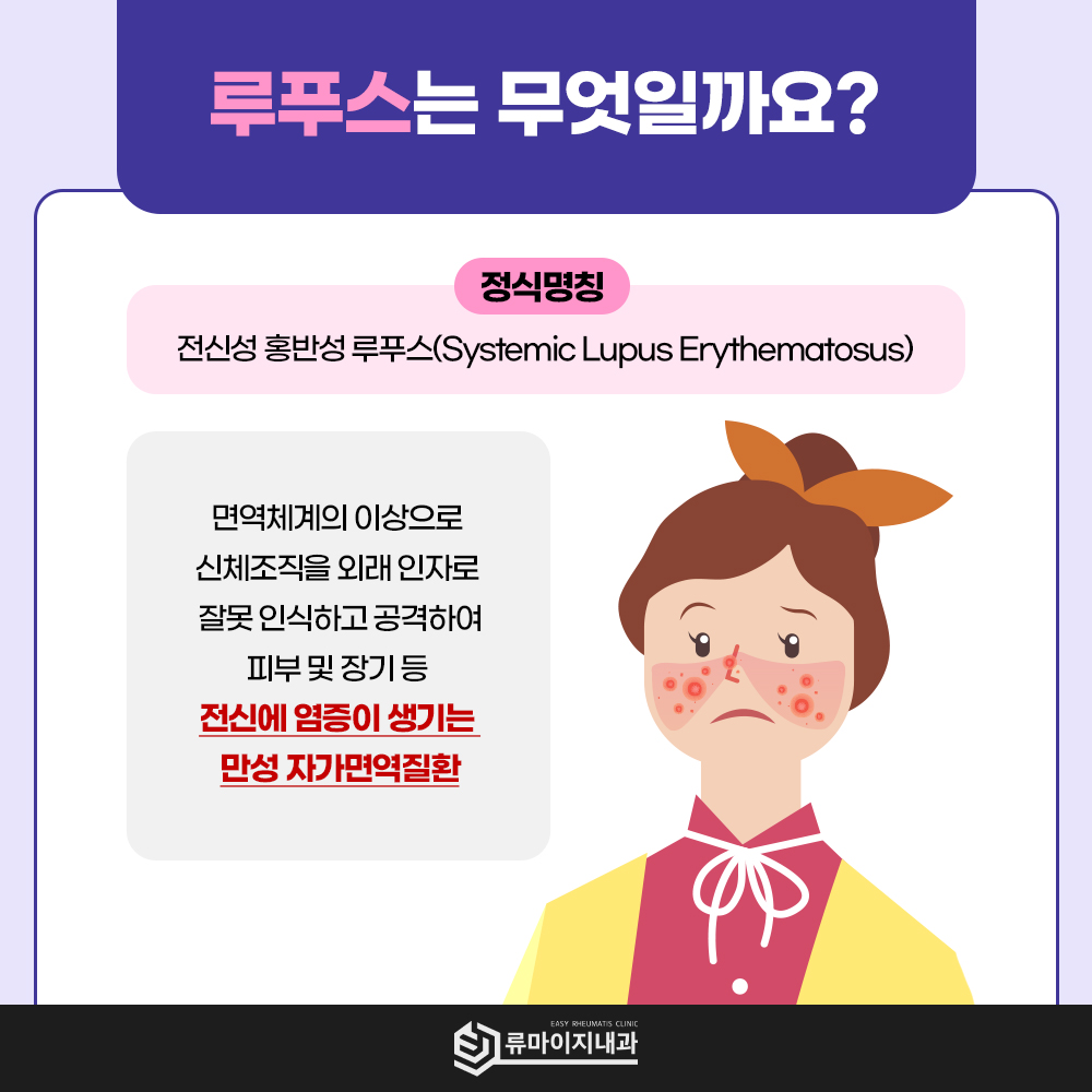 루푸스 증상 나비발진 볼홍조 