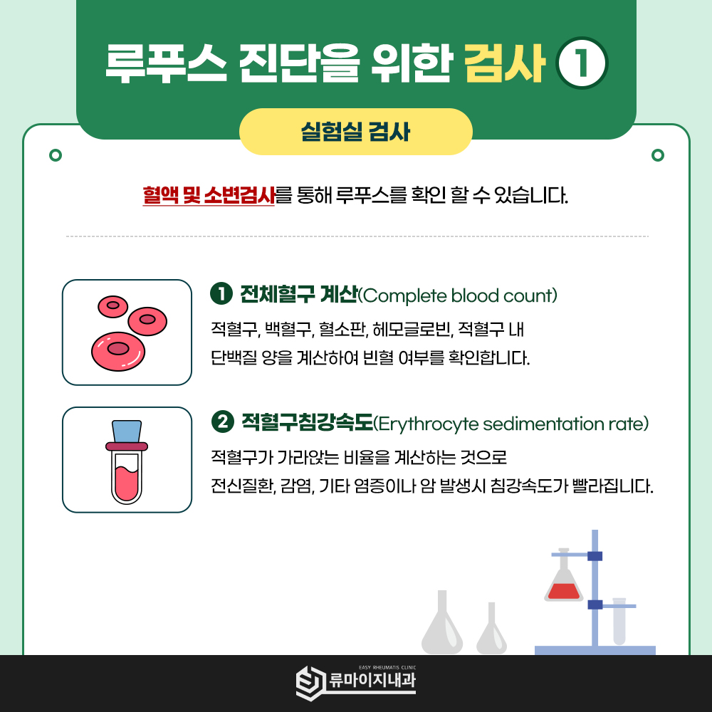 루푸스 진단 검사 전체혈구 계산 적혈구 침강속도 