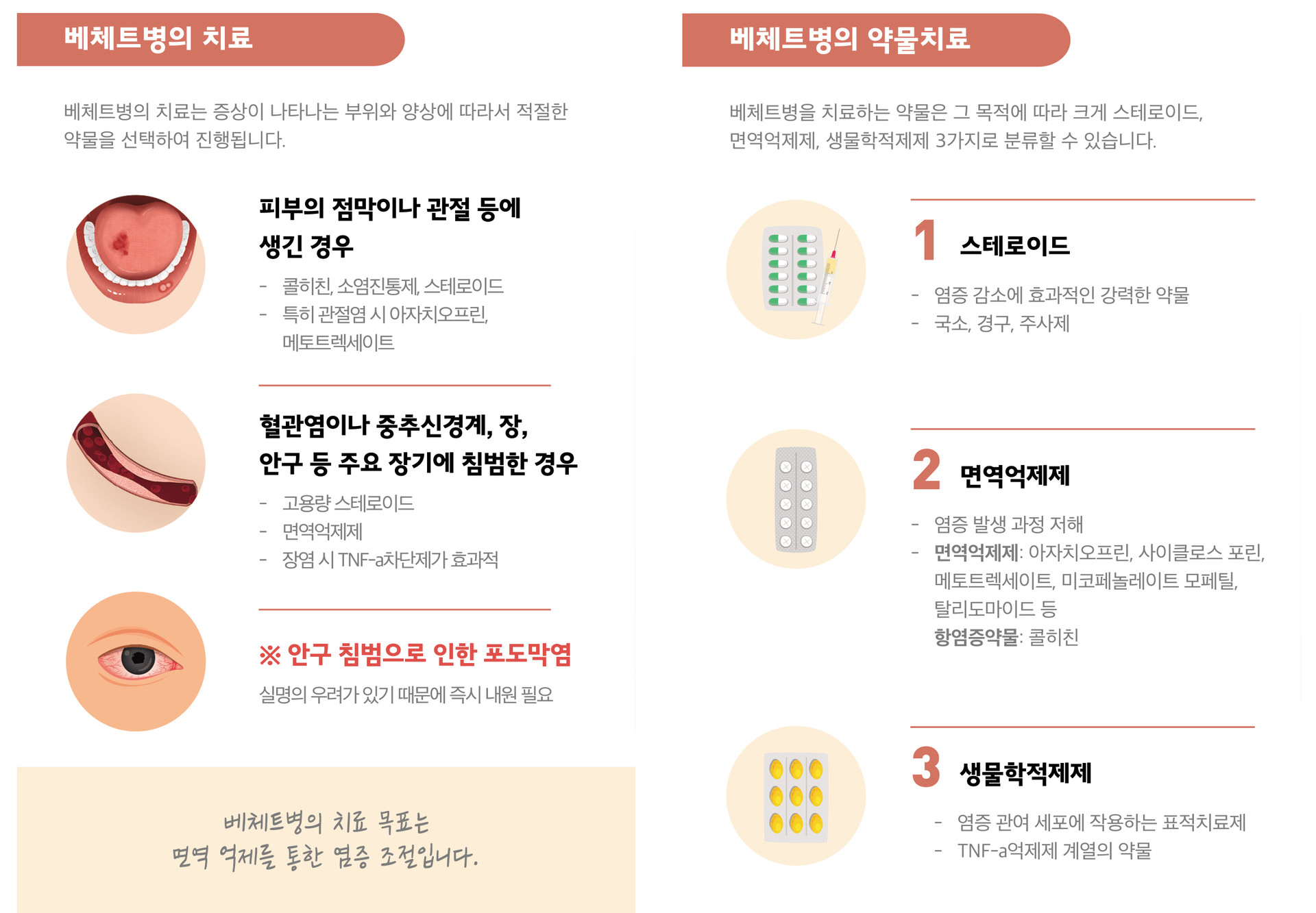 베체트병치료 스테로이드 면역억제제 생물학적제제 