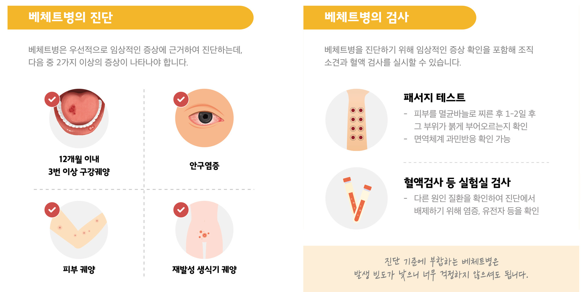 베체트병진단 베체트병검사 패서지테스트 