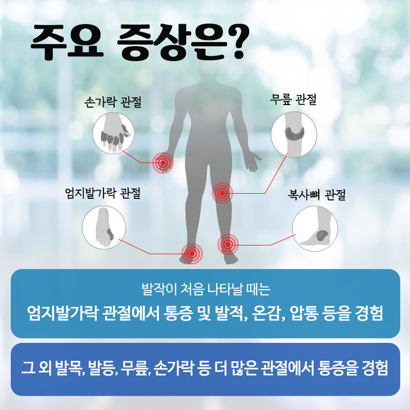 통풍 엄지발가락 손가락 무릎 복사뼈 통증 발적 온감 압통 