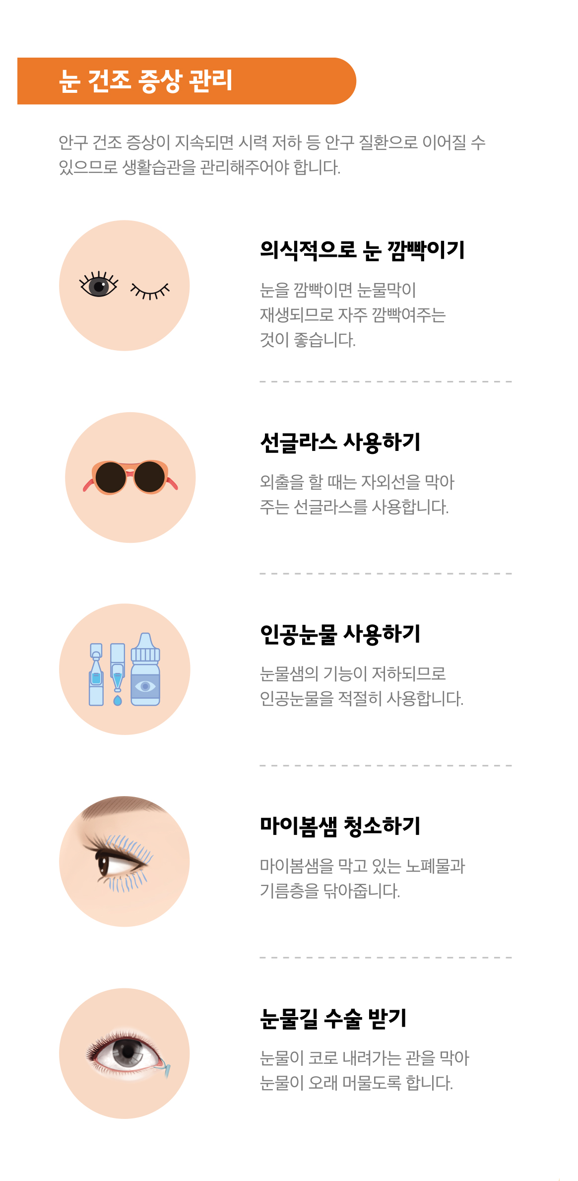 쇼그렌증후군 안구건조관리 