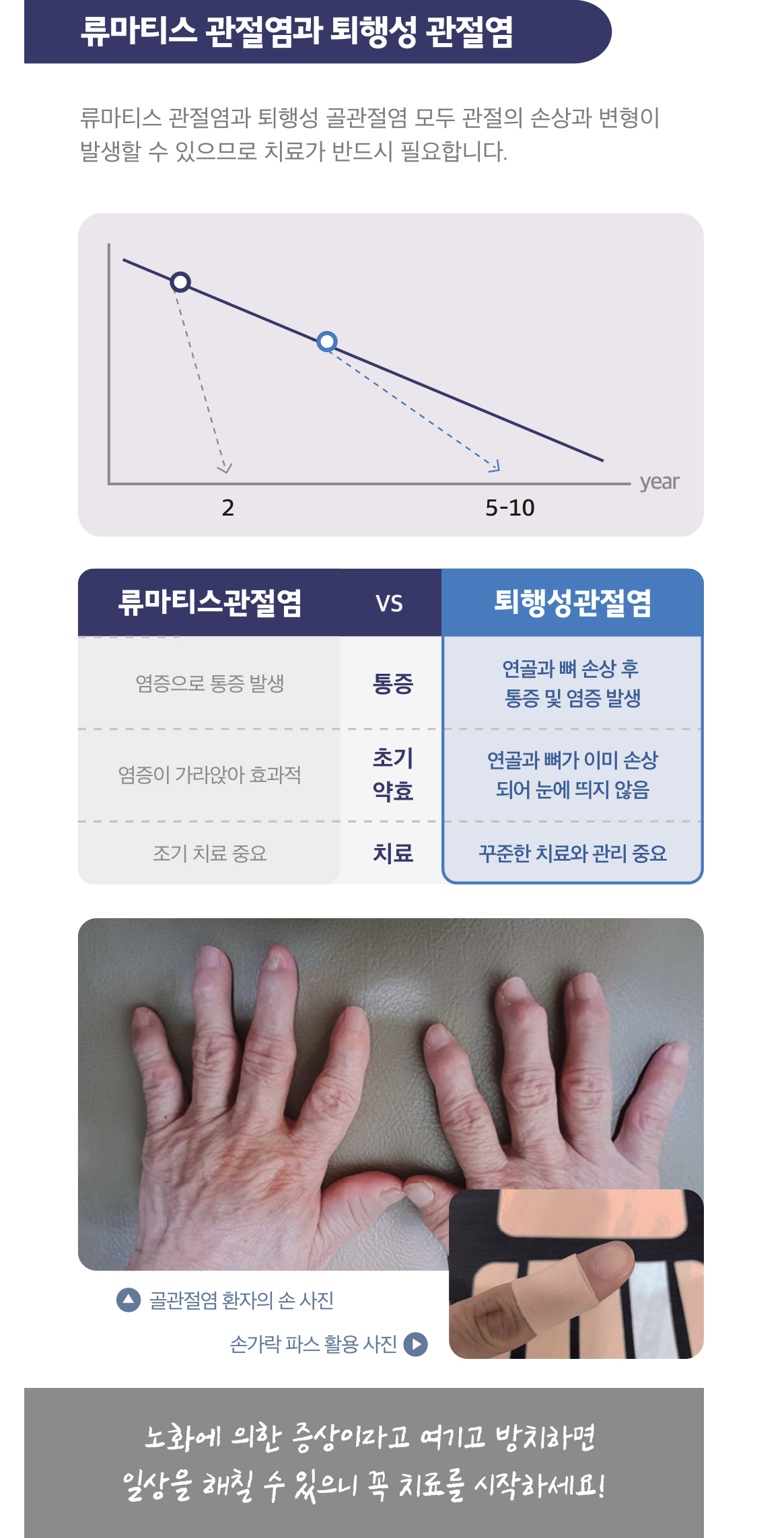 류마티스관절염 퇴행성관절염 연골 통증 염증 