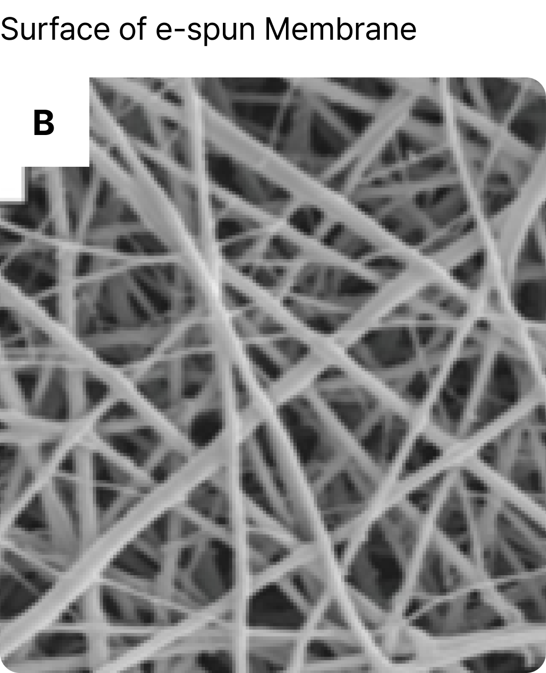 <a href="https://www.jove.com/t/4172/postproduction-processing-of-electrospun-fibres-for-tissue-engineering"     target="_blank"     rel="noopener noreferrer"     style="color: #6D7280; font-family: Pretendard;           font-size: 11px;           font-style: normal;           font-weight: 400;           line-height: 120%;            text-decoration-line: underline;           text-decoration-style: solid;           text-decoration-skip-ink: auto;           text-decoration-thickness: auto;           text-underline-offset: auto;           text-underline-position: from-font;           display: block;           text-align: left;">이미지 출처 보기</a>