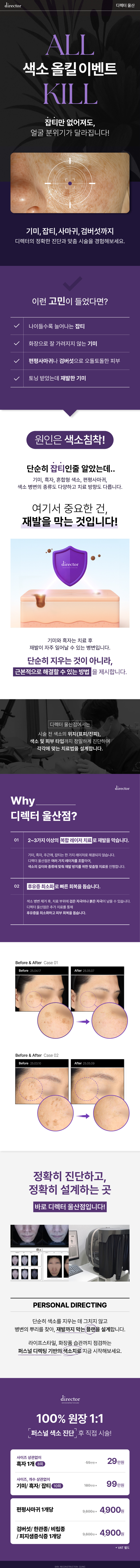 기미·잡티·검버섯·편평사마귀 등 다양한 색소 질환을 복합 레이저로 안전하게 개선하는 진단 맞춤 시술 - 울산흑자제거