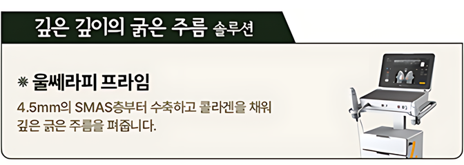 깊은 깊이의 굵은 주름 솔루션 울쎄라피 프라임