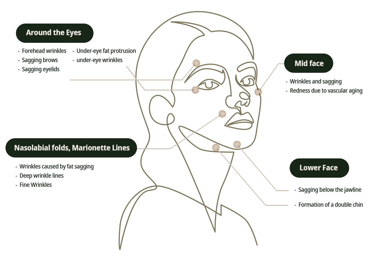 Because signs of aging vary by area