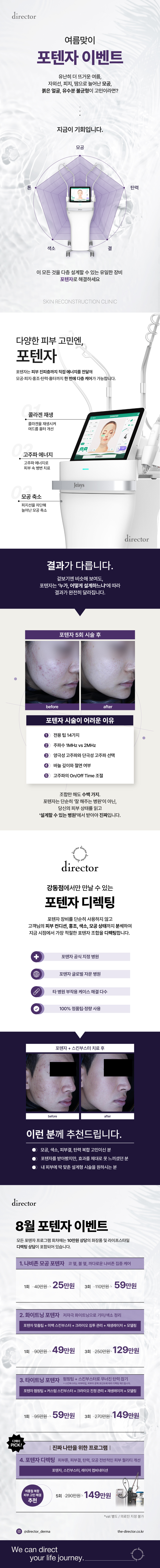 포텐자 리프팅 – 나비존 모공·피부결 개선과 톤업 효과를 함께 기대할 수 있는 스킨부스터 레이저 시술