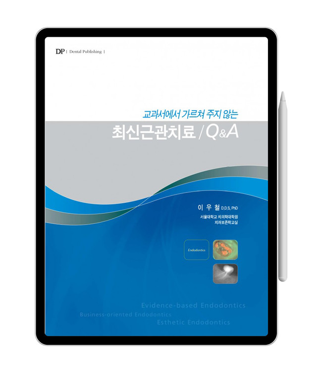 [e-Book] 교과서에서 가르쳐 주지 않는 최신 근관치료 Q&A