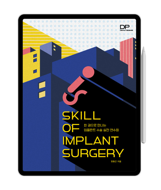 [e-Book] SKILL OF IMPLANT SURGERY
