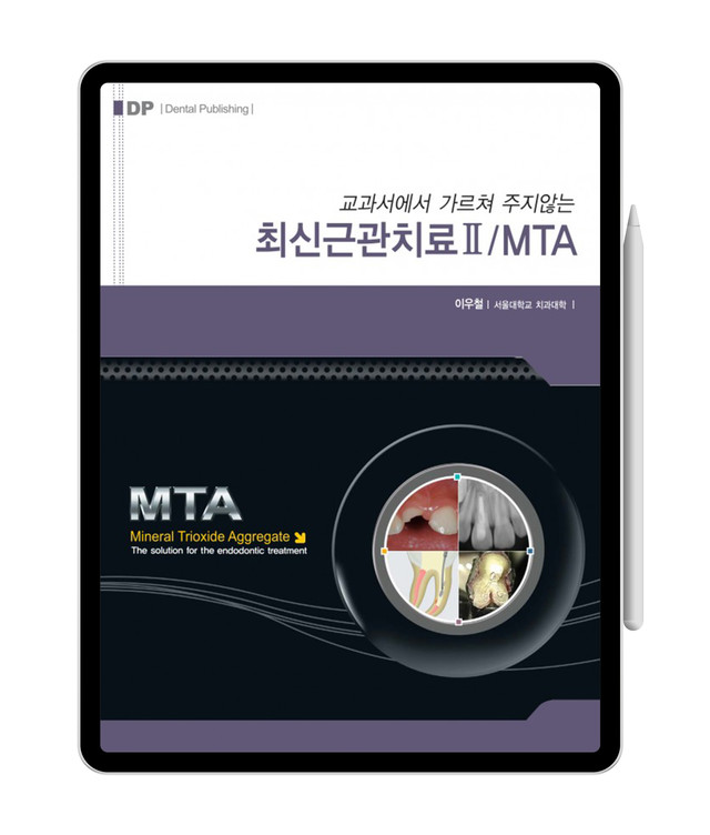 [e-Book] 교과서에서 가르쳐 주지 않는 최신근관치료Ⅱ / MTA