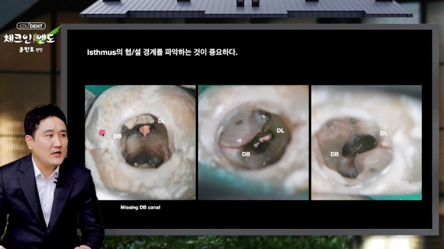 Canal보다 중요한 Isthmus 탐색 전략