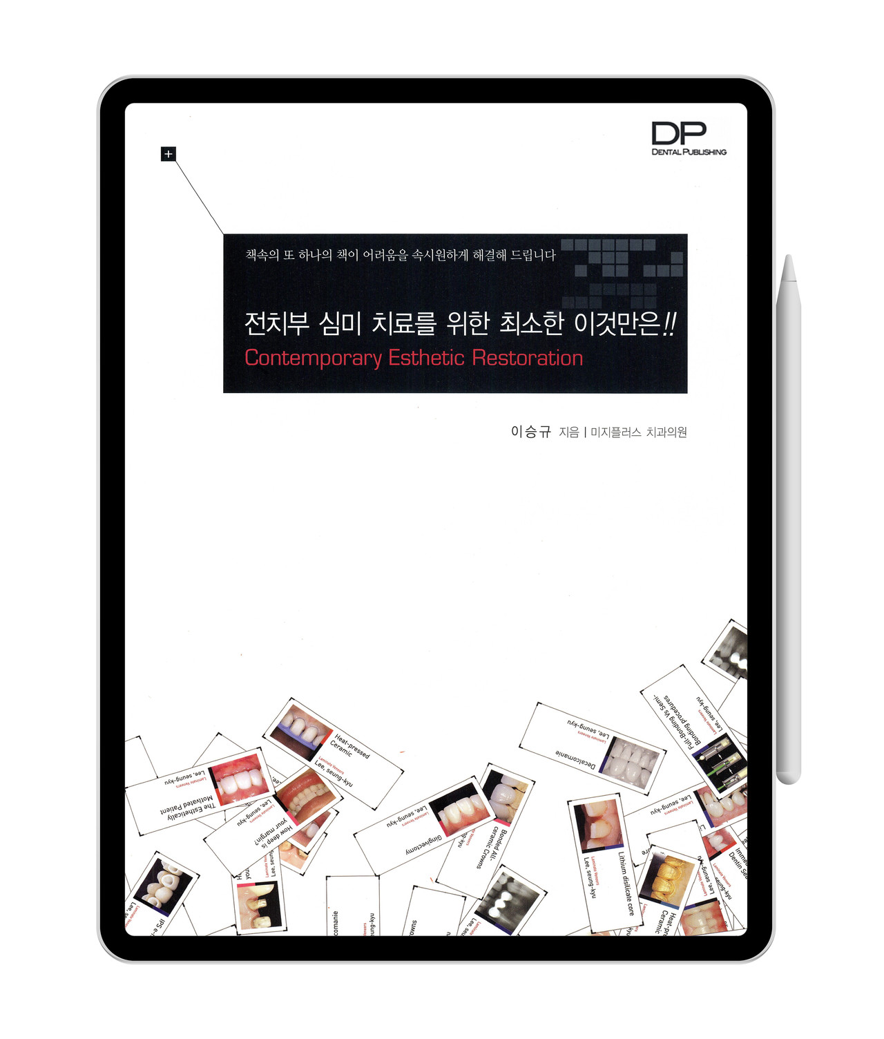 [e-Book] 전치부 심미 치료를 위한 최소한 이것만은