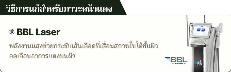 วิธีการแก้สำหรับภาวะหน้าแดง