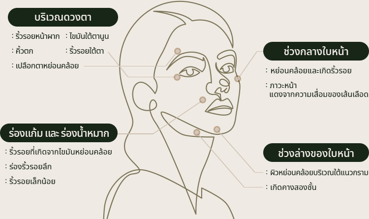 เพราะความหย่อนคล้อยของผิว แสดงออกต่างกันในแต่ละจุด
