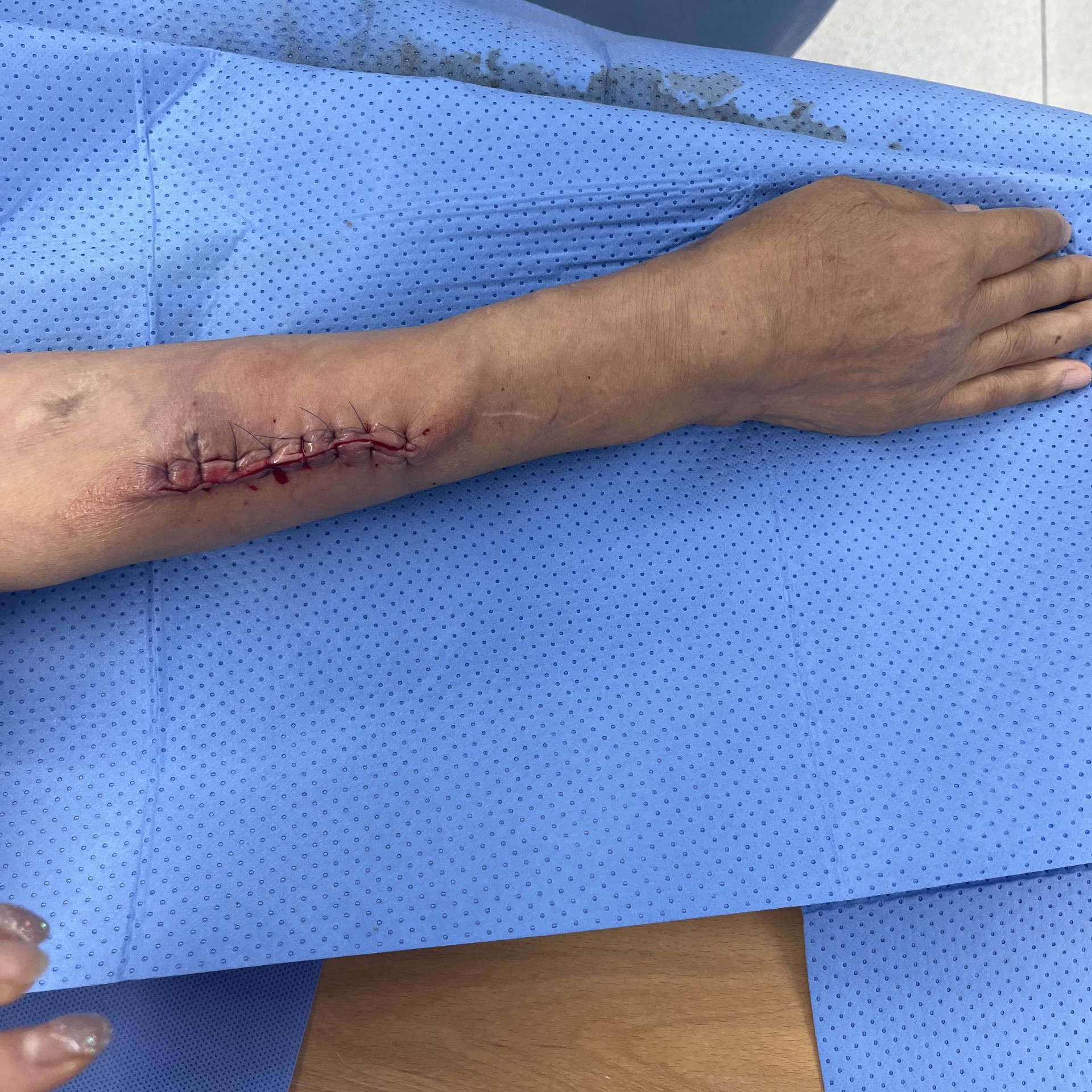 축소술 후의 모습