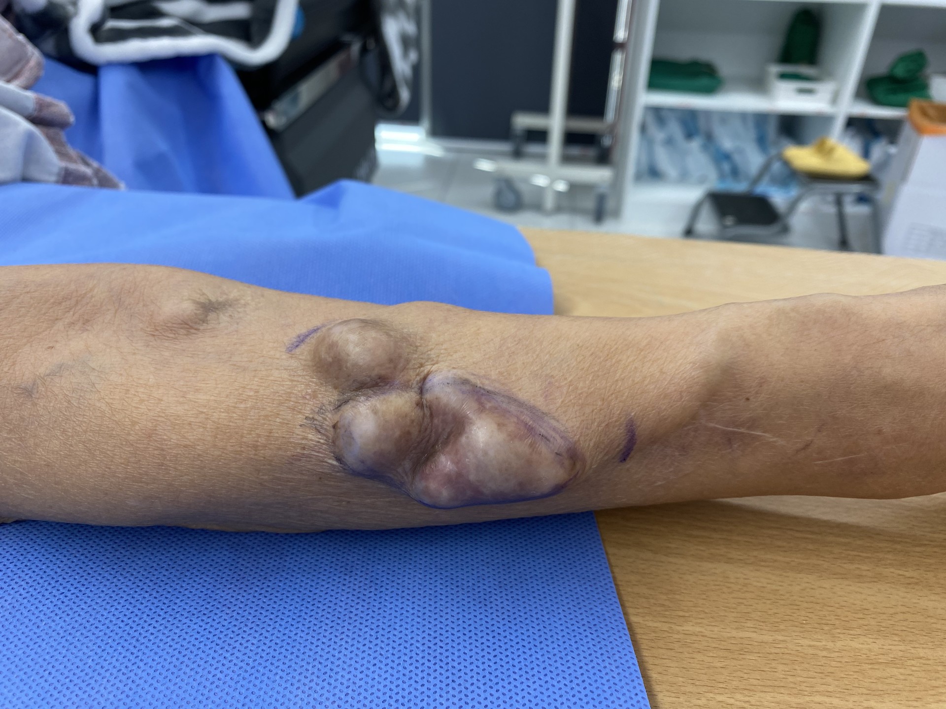 축소술 전의 모습