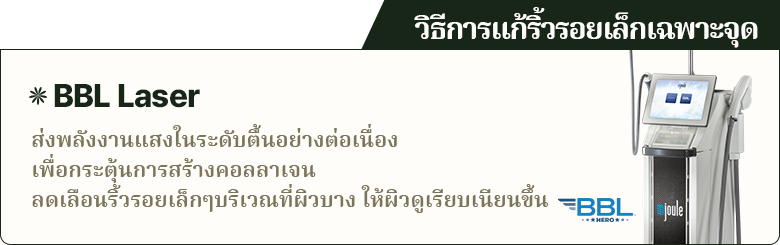 วิธีการแก้ริ้วรอยเล็กเฉพาะจุด