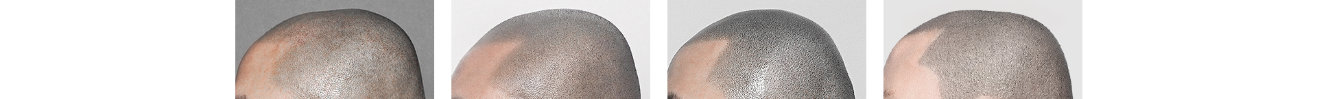 그레이시티 잠실 본점 삭발 SMP 두피문신 독보적 기술로 개인에 맞는 두상 디자인 구현 네츄럴 밸런스 패션 제네시스