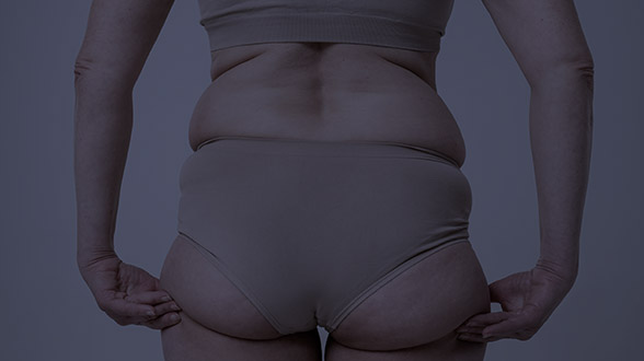  <p><font size=3px>2+10 DIET CLINIC</font><br>ㅡ<br><br><font size=5.5px><b>얼굴없는 한의사<br>다이어트</b></font></p>