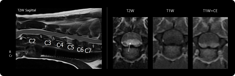 내과적 치료. 전신 상태가 비교적 안정적이고, 폐색이 일시적이거나 부분적인 경우 약물치료, 수액요법, 항생제 치료 등을 통해 염증을 가라앉히는 접근을 시도할 수 있습니다. 담낭 절제술, 총담관 세정술, 필요시 담도 제거술까지 포함될 수 있으며, 환자 상태에 따라 복합적으로 진행됩니다.