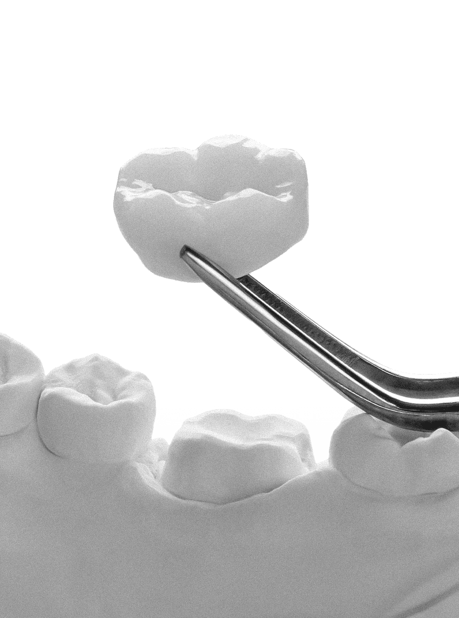 은계지구-클리어치과-크라운치료-크라운치료대상