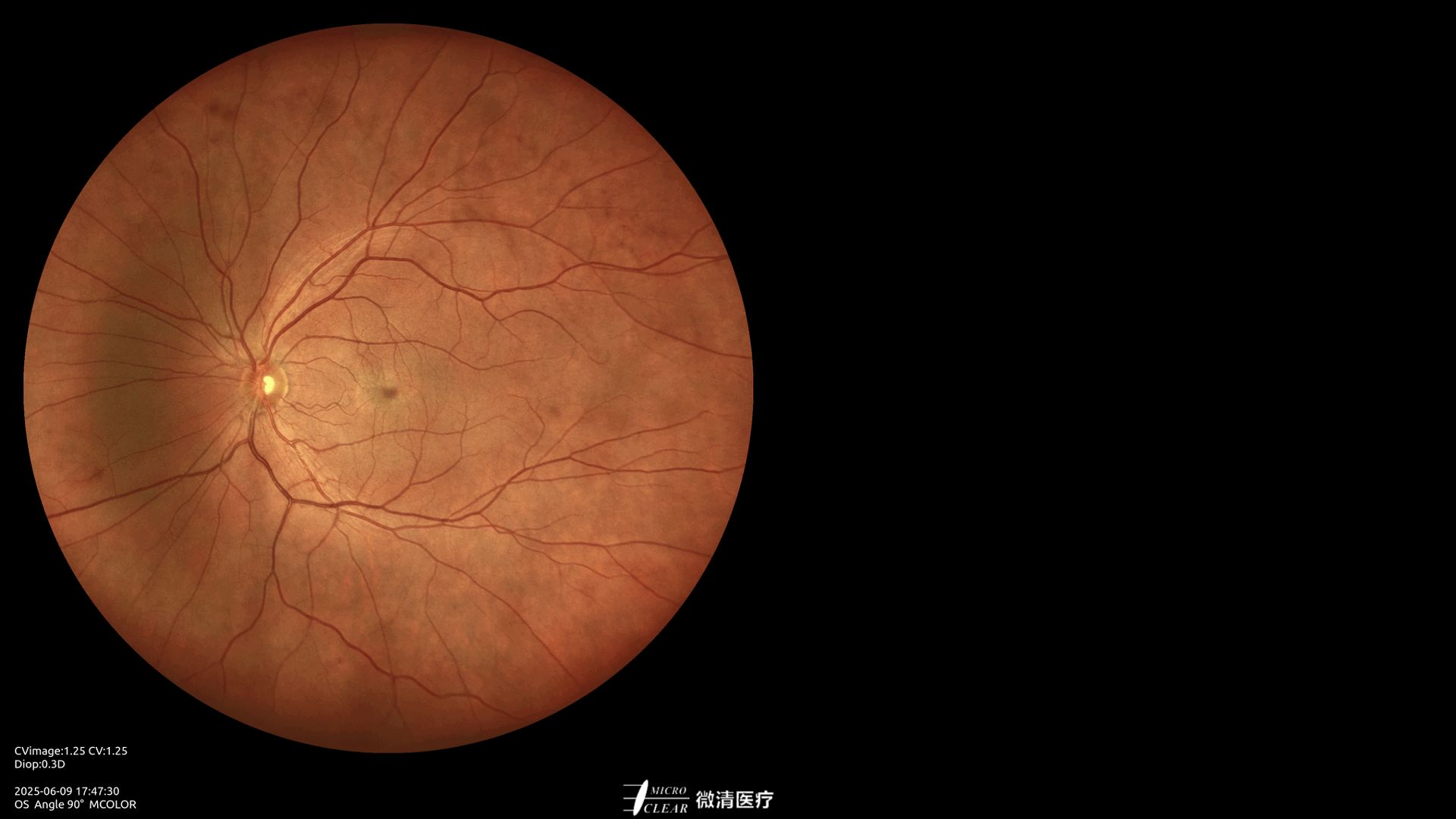 미래는 과거와 같지 않다 -요기베라