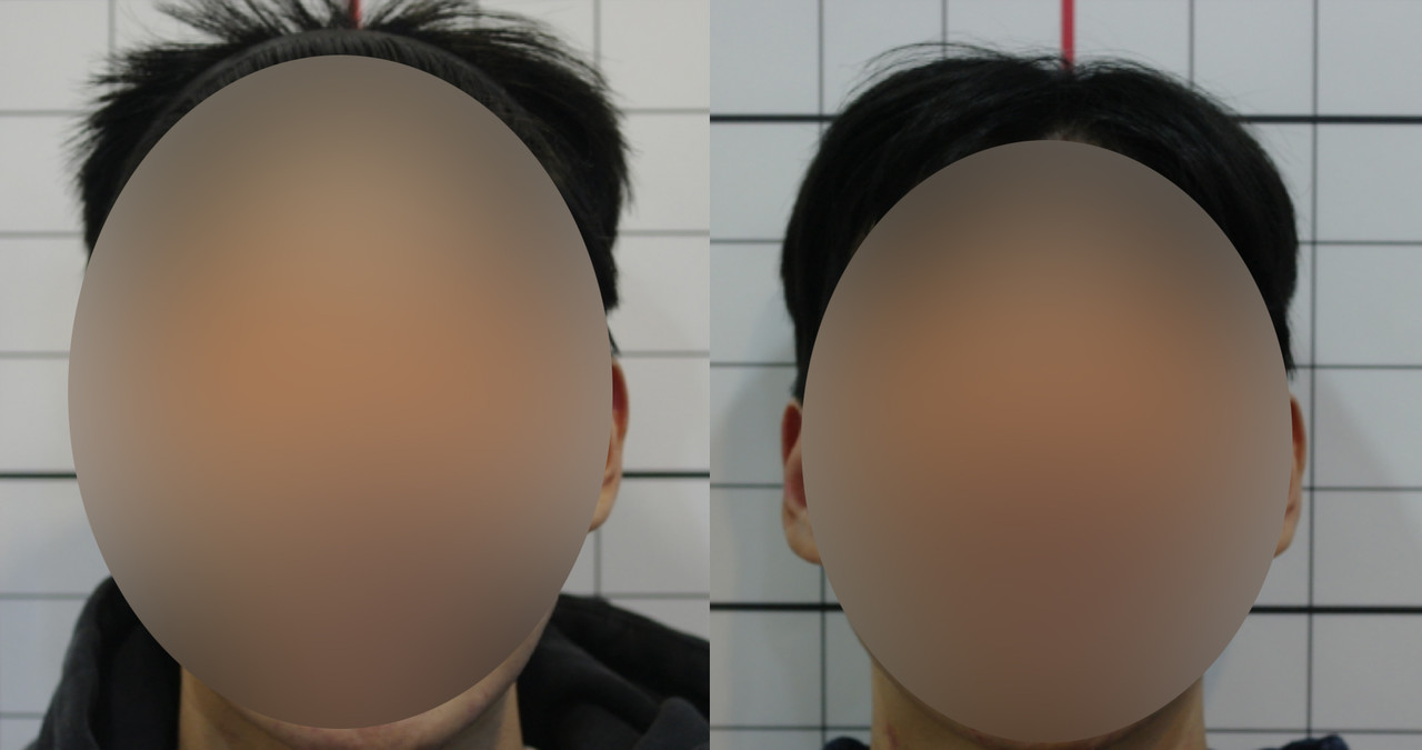 치료사례 보러가기