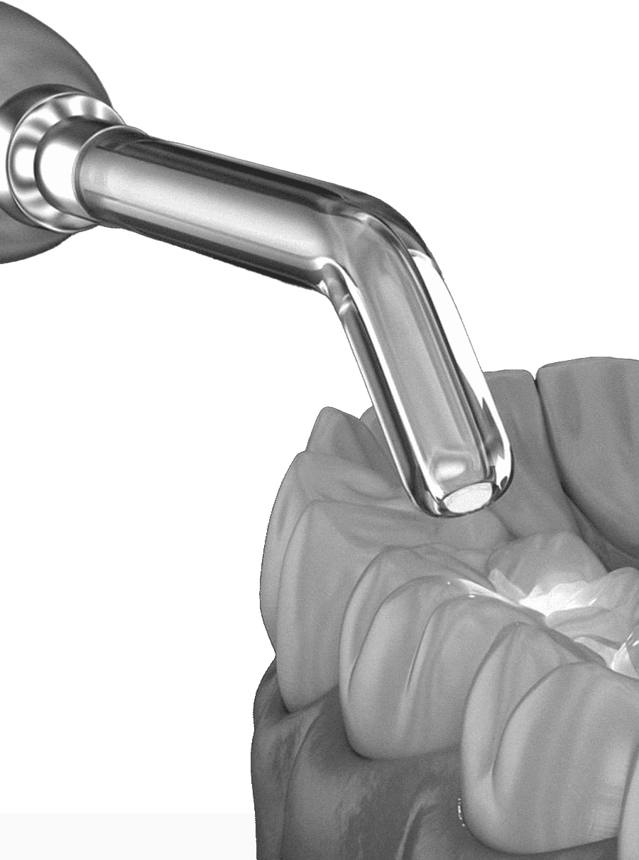 은계치과-시흥은행동치과-클리어치과-레진치료-치료대상