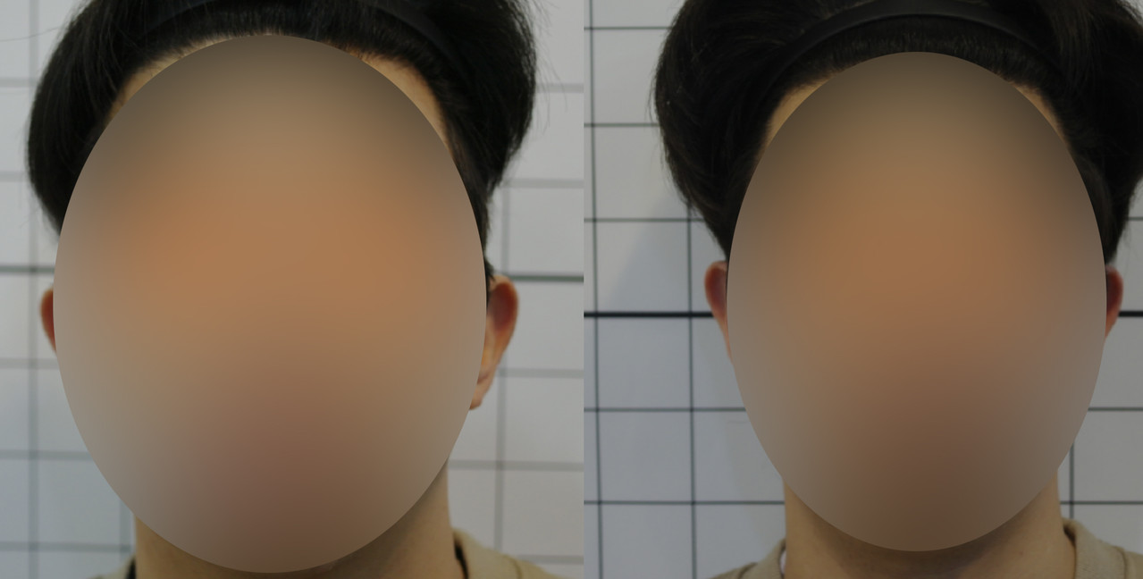 치료사례 보러가기