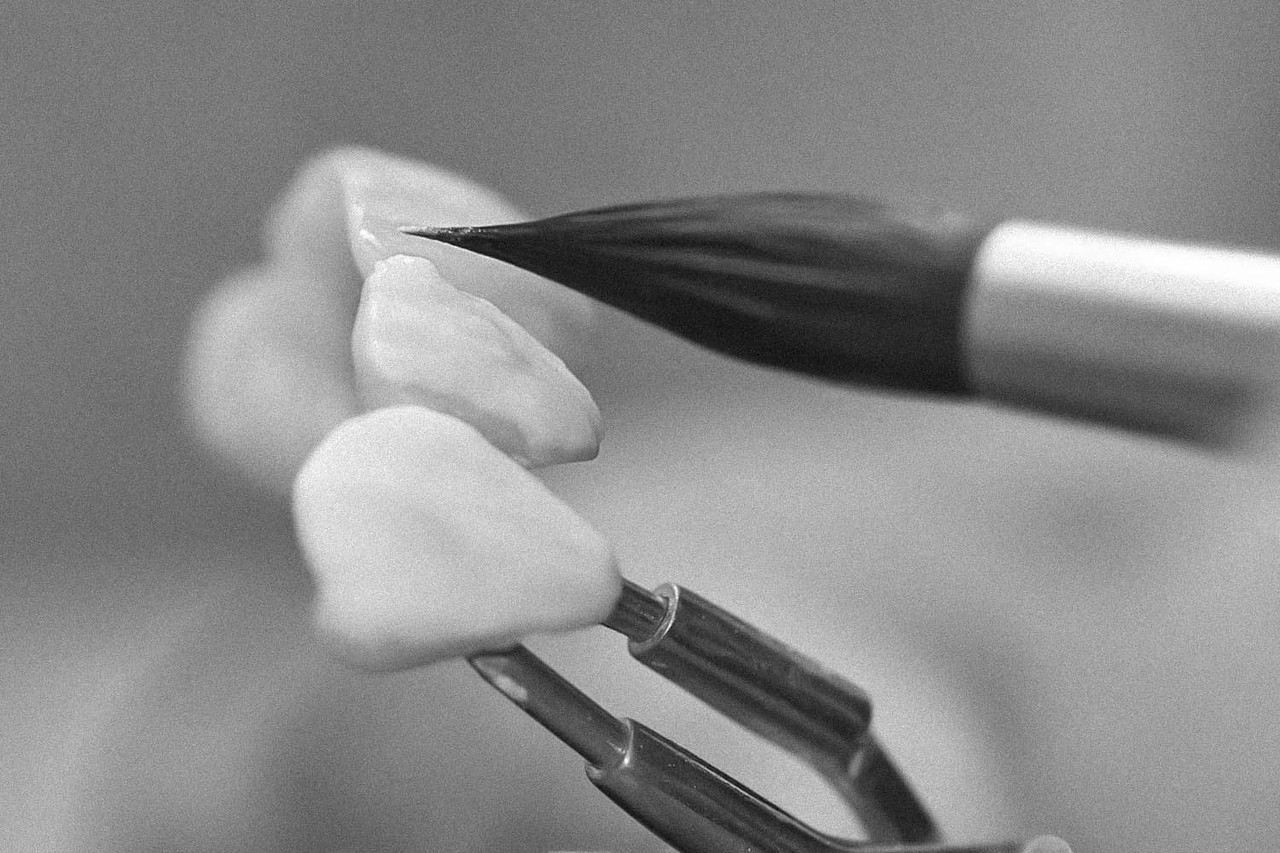 은계지구-클리어치과-무삭제라미쉬-맞춤제작