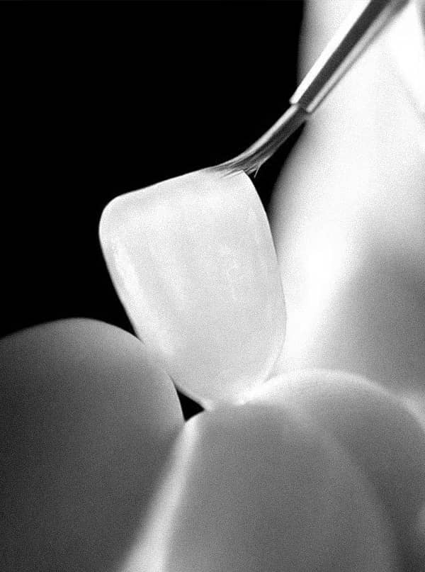 은계지구-클리어치과-심미센터-무삭제라미쉬소개