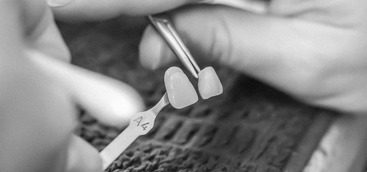 은계지구-클리어치과-무삭제라미쉬-자연치아보존