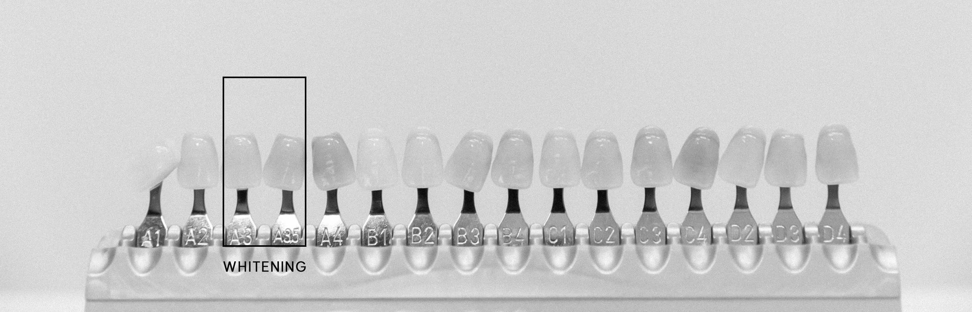 은계지구-클리어치과-치아미백-치료과정