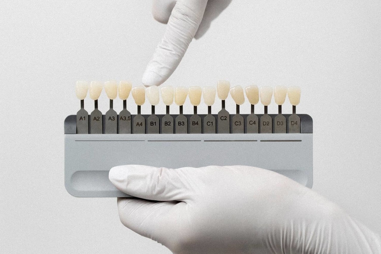 은계지구-클리어치과-치아미백장점