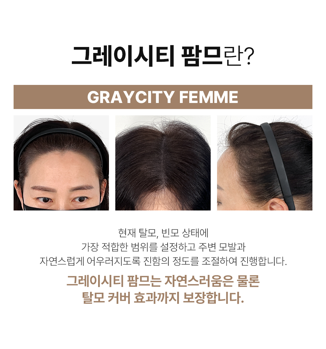 그레이시티 잠실 본점 팜므 SMP 여성 두피문신 엑설런스 그레이스 소프트 탈모커버