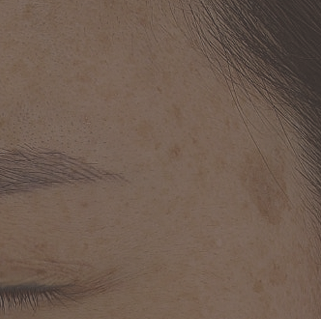 얼굴의 흑자, 검버섯을 벗겨버리는 방법은?