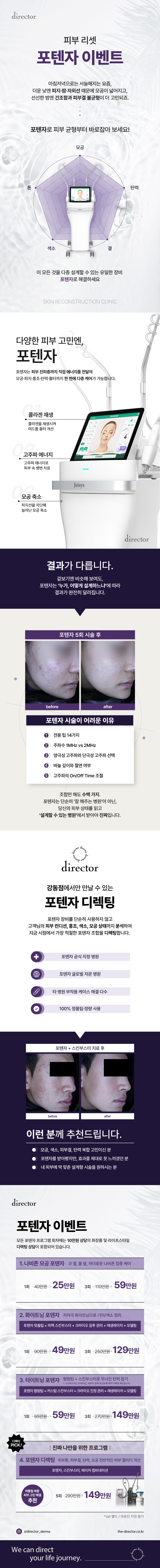 포텐자 리프팅 – 나비존 모공·피부결 개선과 톤업 효과를 함께 기대할 수 있는 스킨부스터 레이저 시술