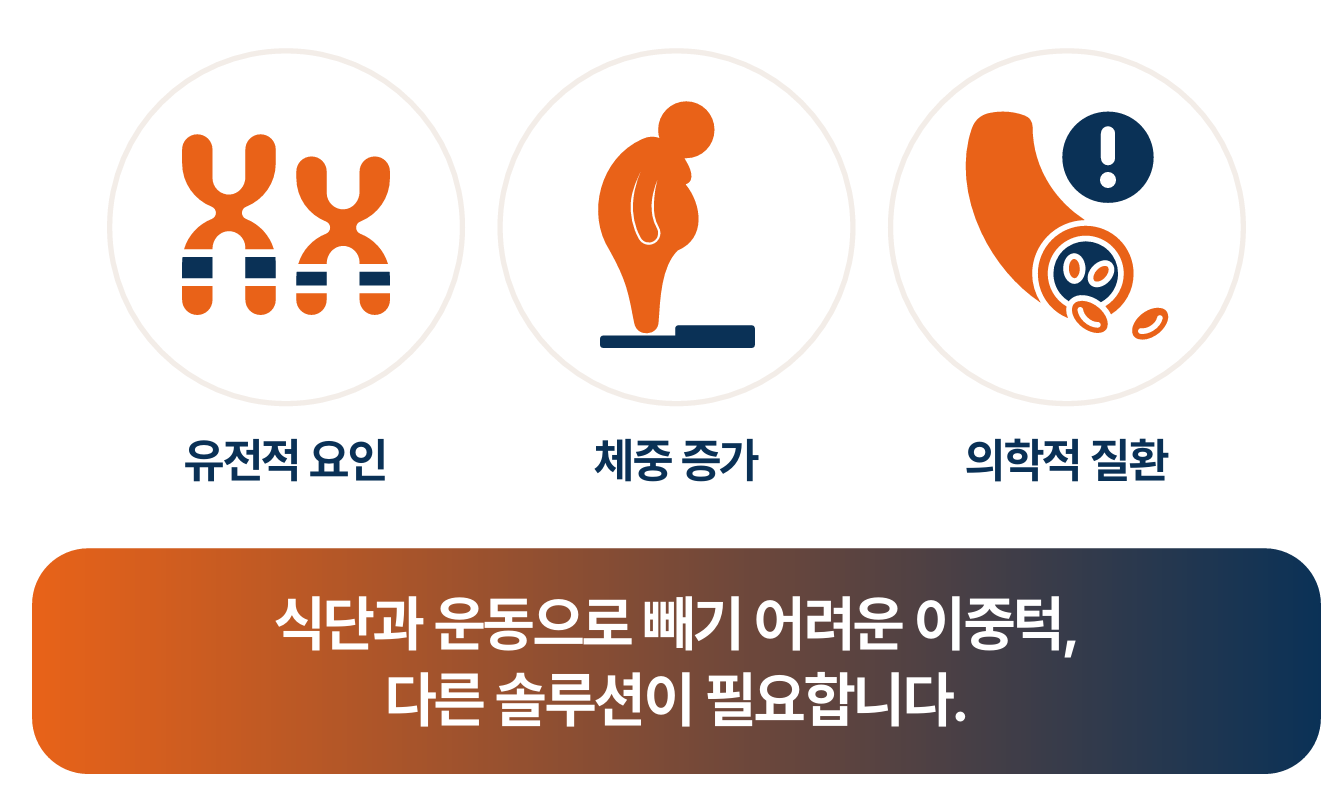 식단과 운동으로 빼기 어려운 이중턱, 다른 솔루션이 필요합니다 원주피부과 바이블주 디씨에이주사