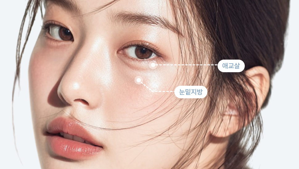 IS-under-eye-fat-img