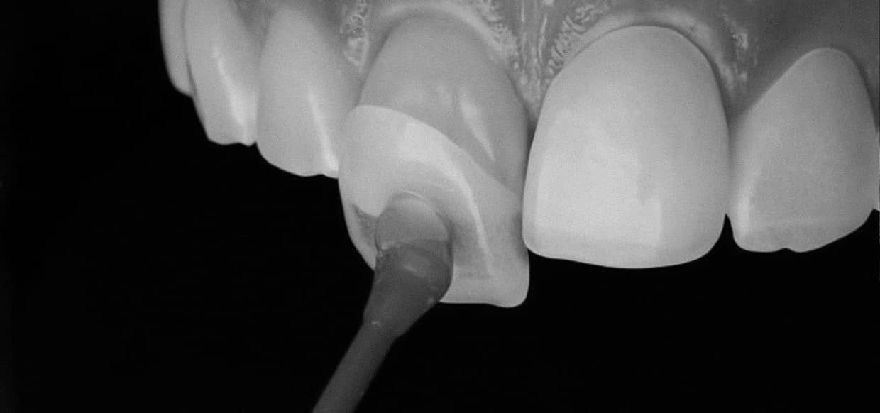 은계치과-시흥은행동치과-클리어치과-심미센터-자연치아보존진료