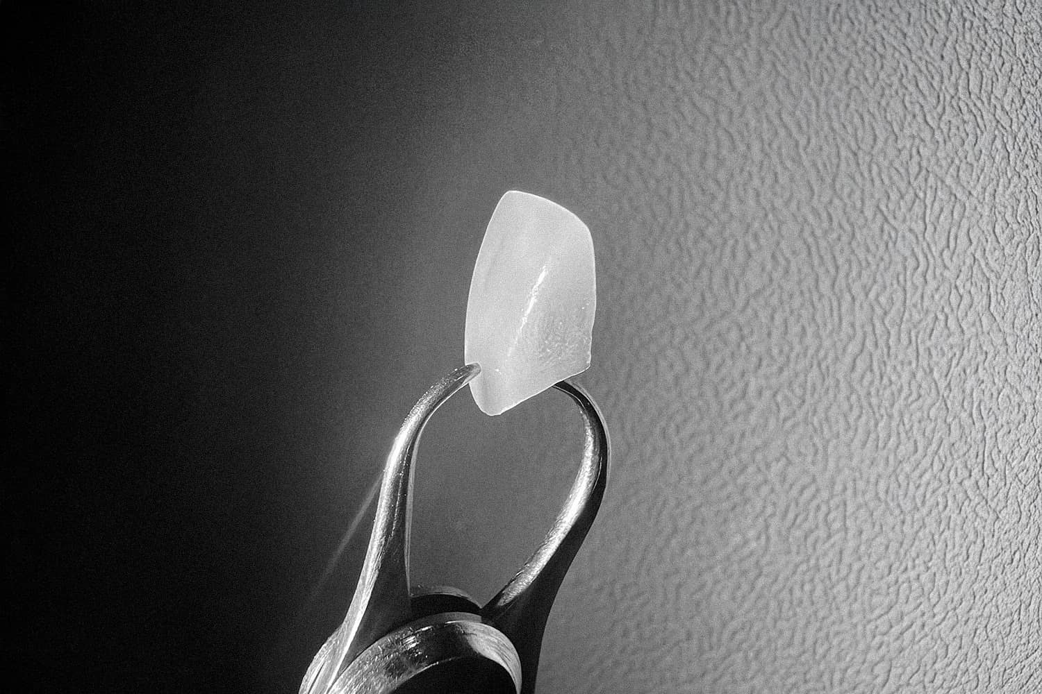 은계치과-시흥은행동치과-클리어치과-무삭제라미쉬-초정밀제작방식