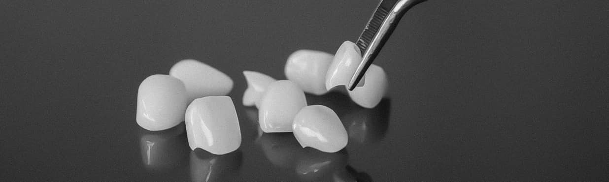 은계치과-시흥은행동치과-클리어치과-무삭제라미쉬-맞춤디자인제작