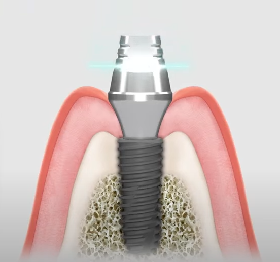 정교한 디지털 인상