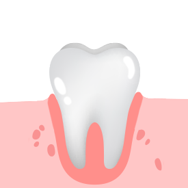 건강한 잇몸치아