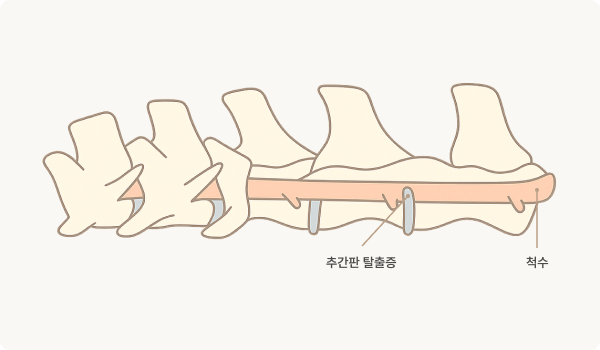디스크