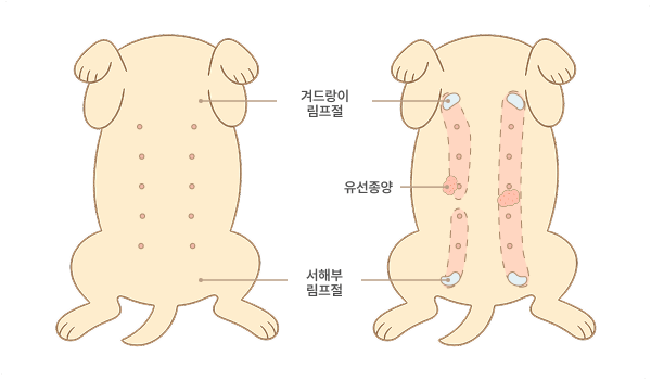 유선암 (유선종양)